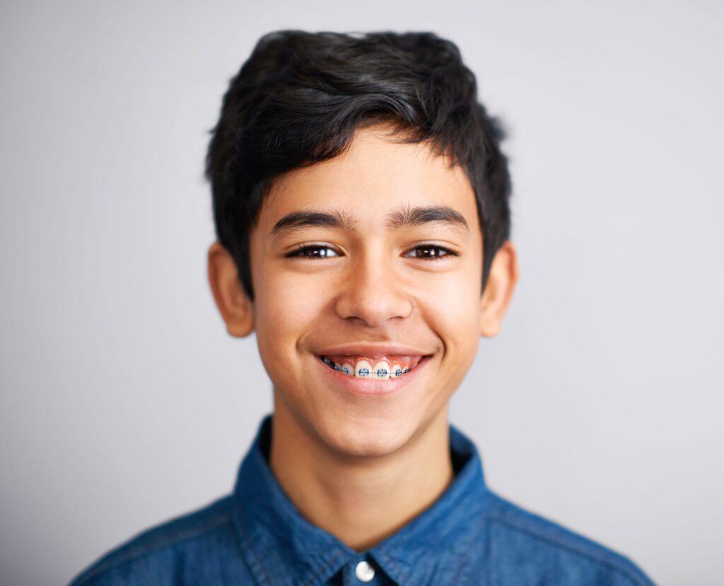 Braces in Stinson Beach